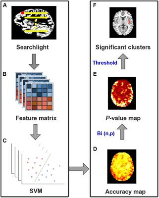 Characterizing the Structural Pattern Predicting Medication Response in Herpes Zoster Patients Using Multivoxel Pattern Analysis